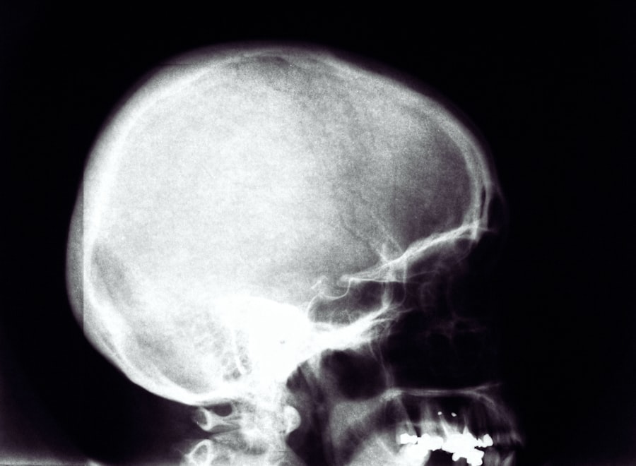 Photo X-Ray