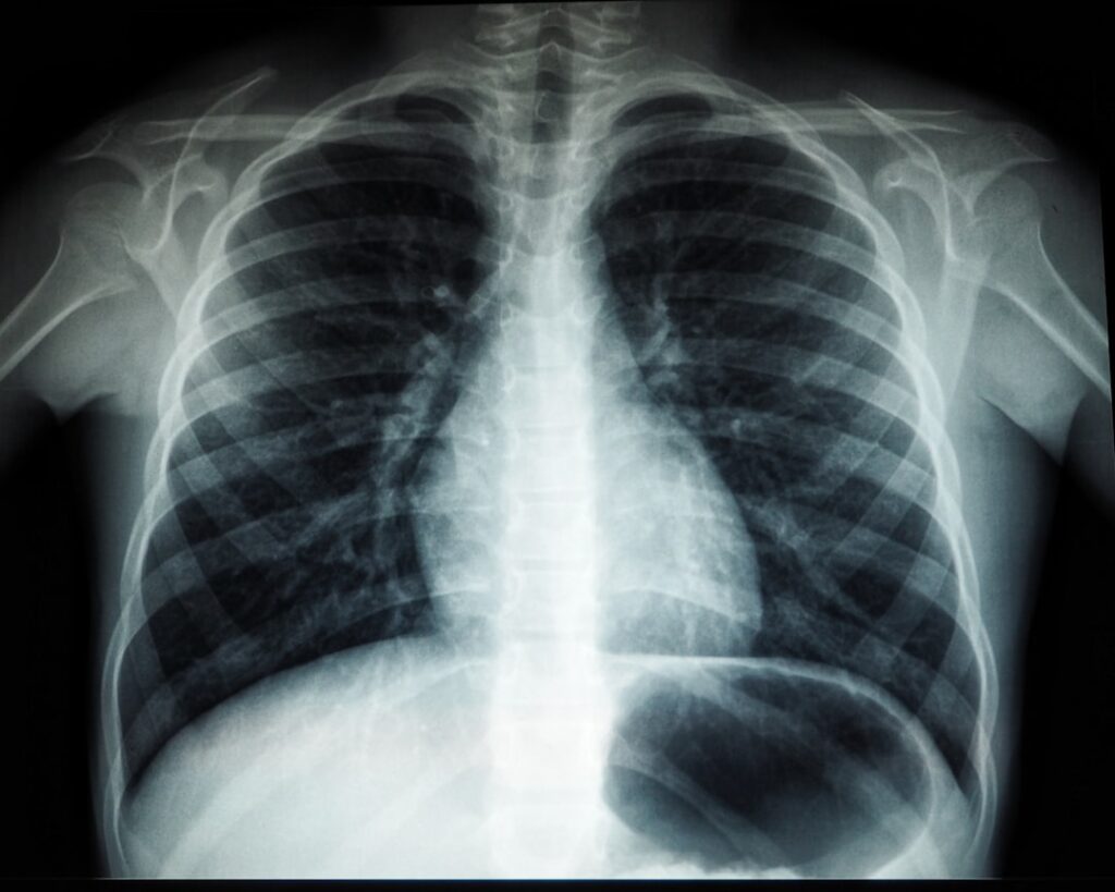 The X-Ray: A Powerful Diagnostic Tool